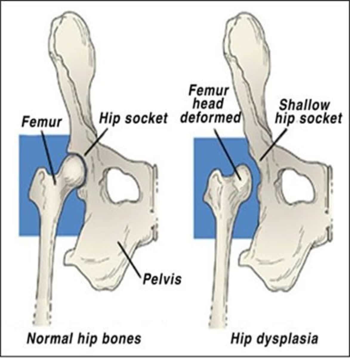 A Simple Guide to Hip Dysplasia in Dogs